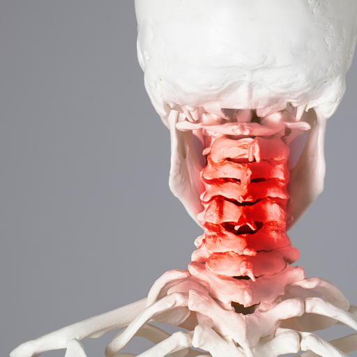 Relever le défi de la Cervicobrachialgie : Du diagnostic à la prise en charge (2026-05-01 - 2026-08-01)