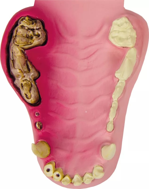 Mâchoire canine saine/malade