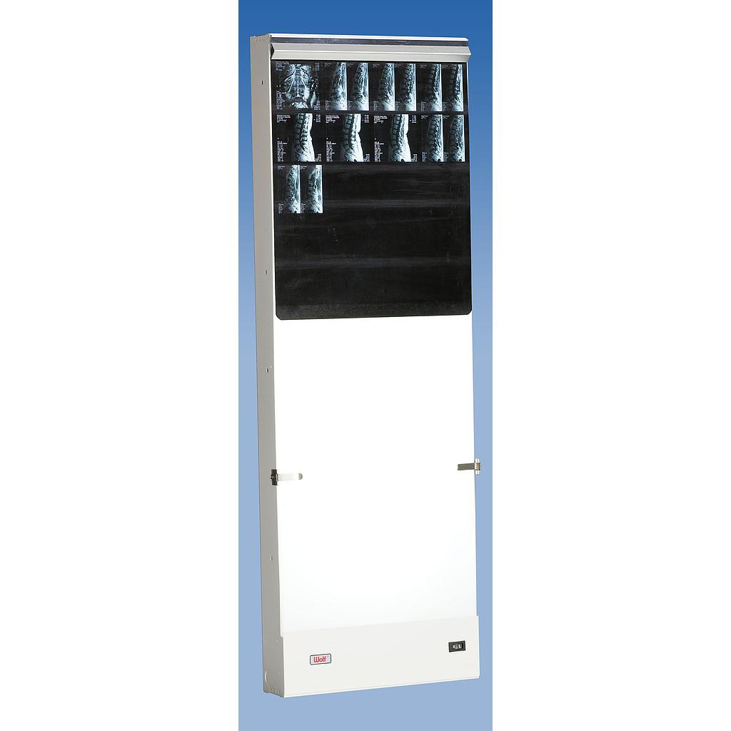 [107-133] Négatoscope simple Trimline Spinal -  35 cm (14") x 91 cm (36") - rég. 499,00$ {↓}